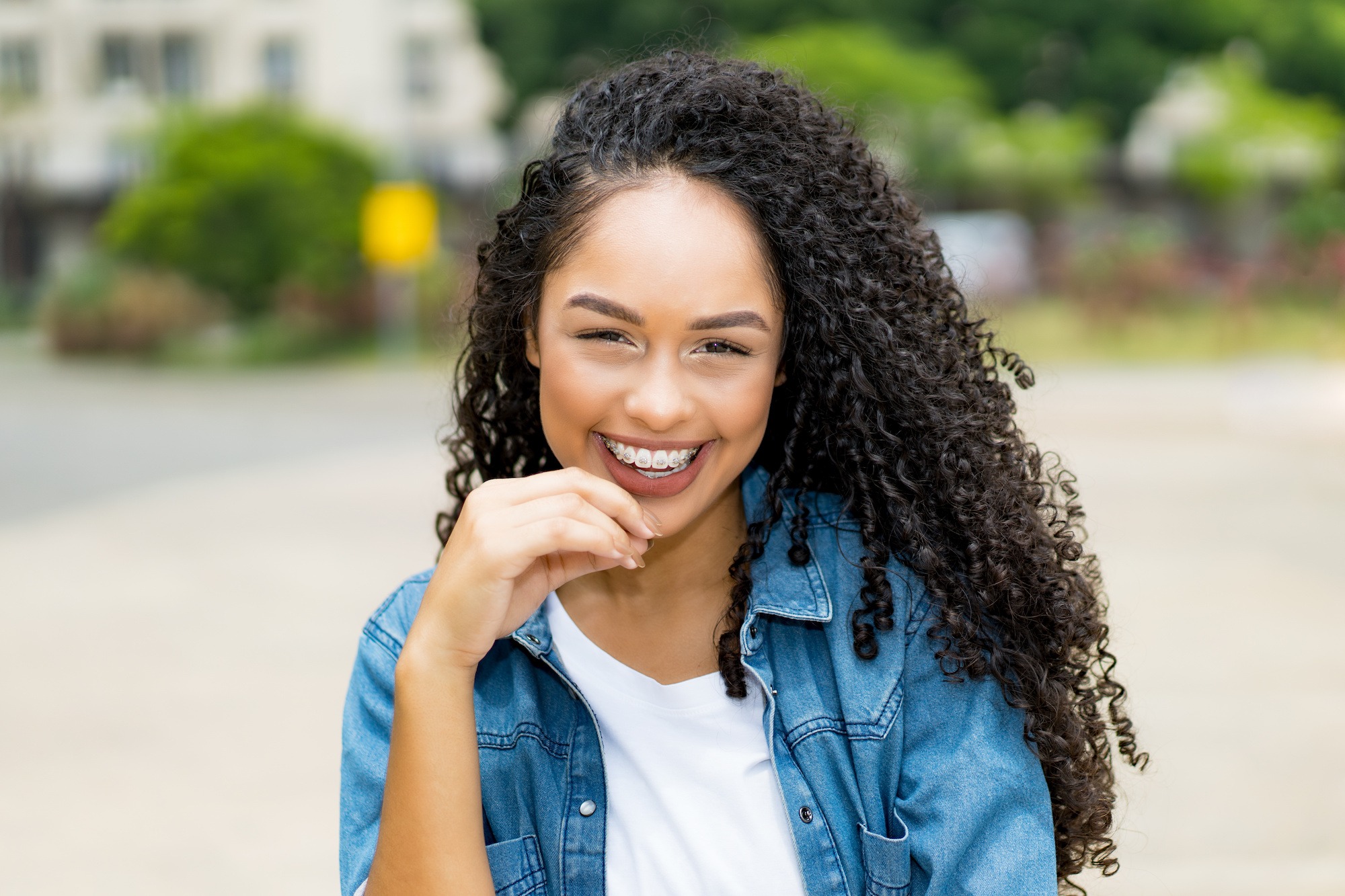 clear braces on model