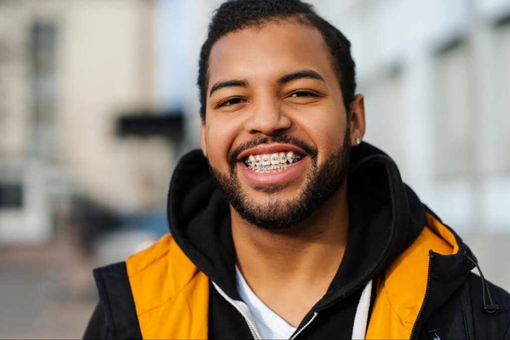 What Orthodontic Treatment is Best for Adults?