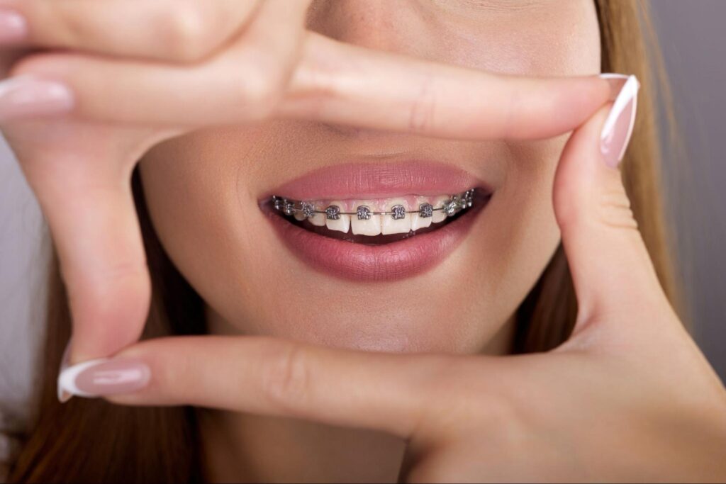 Affordable Orthodontic Options in Suffolk